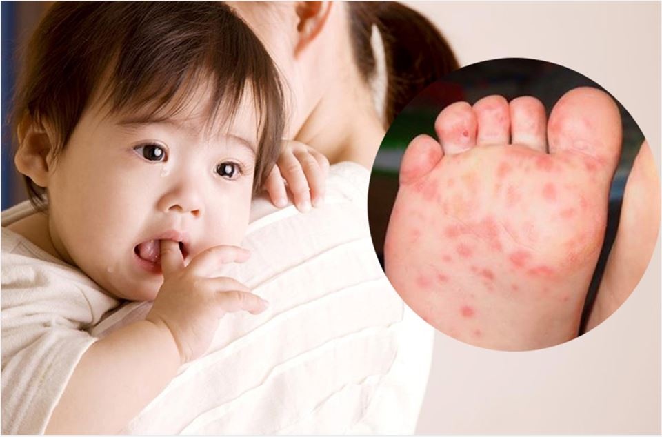 Bảo vệ sức khỏe mùa dịch Bảo vệ sức khỏe mùa dịch
