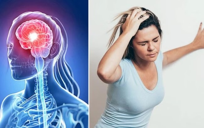Lối sống xấu khiến đột quỵ gia tăng ở người trẻ