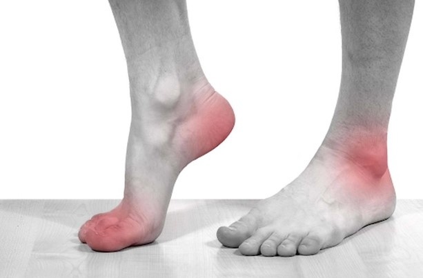 Phòng bệnh gout từ chính bữa ăn hàng ngày Phòng bệnh gout từ chính bữa ăn hàng ngày