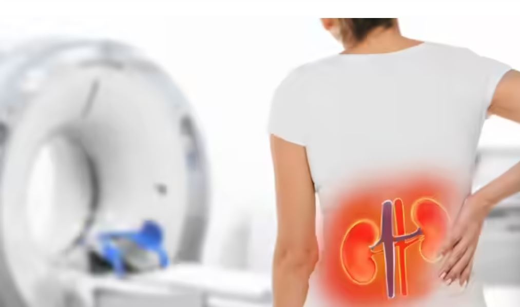 5 giai đoạn của bệnh thận mãn tính: Nhận diện các triệu chứng