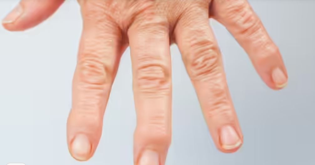 Những bộ phận nào trên cơ thể bắt đầu giãn ra đầu tiên khi chúng ta già đi? Những bộ phận nào trên cơ thể bắt đầu giãn ra đầu tiên khi chúng ta già đi?