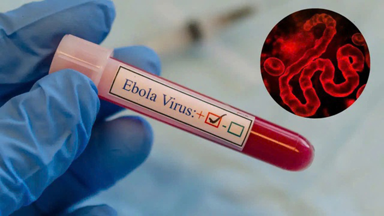 Siết chặt kiểm soát dịch Ebola tại các cơ sở y tế- Ảnh 1. Siết chặt kiểm soát dịch Ebola tại các cơ sở y tế- Ảnh 1.
