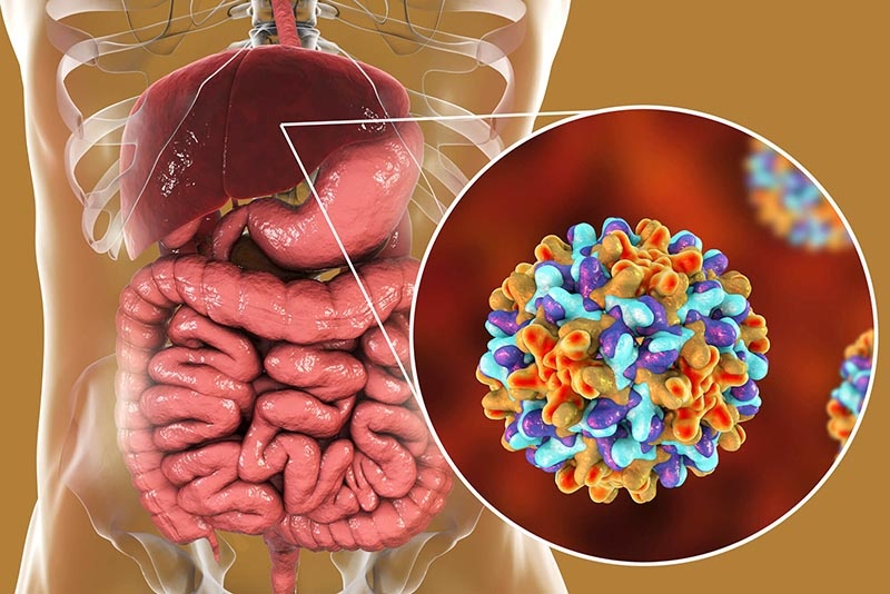 4 loại nước uống càng nhiều gan càng nhanh "hỏng"