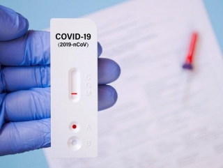 Bộ Y tế làm rõ phản ánh giá xét nghiệm COVID-19 ở mức cao